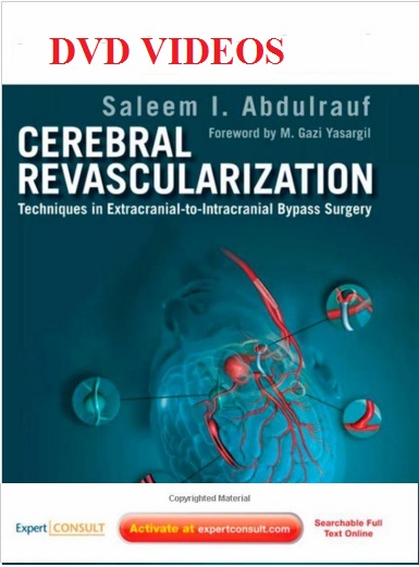 Cerebral Revascularization: Techniques in Extracranial-to-Intracranial Bypass Surgery 1e Edition Original PDF + Video Cerebral Revascularization: Techniques in Extracranial-to-Intracranial Bypass Surgery 1e Edition Original PDF + Video