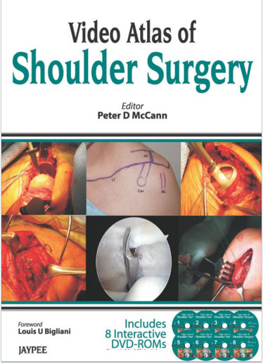 8 DVD VIDEOS Atlas of Shoulder Surgery 8 DVD VIDEOS Atlas of Shoulder Surgery