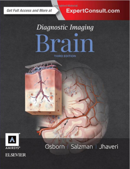 Diagnostic Imaging: Brain, 3e 3rd Edition Diagnostic Imaging: Brain, 3e 3rd Edition