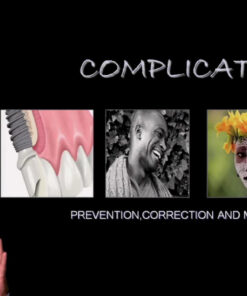 Implant Complications – Prevention, Correction and Maintenance