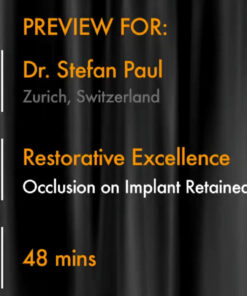 Restorative Excellence – Occlusion on Implant Retained Restorations