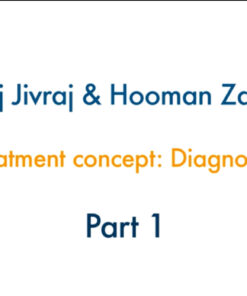 The All on 4 Concept: Diagnosis to Delivery Part 1 – Diagnosis and Treatment Planning, Concepts of Immediate Loading