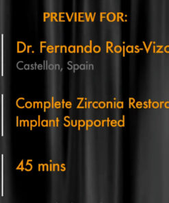 Complete Zirconia Restorations – Implant Supported