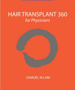 Hair Transplant 360 for Physicians 2  Edition