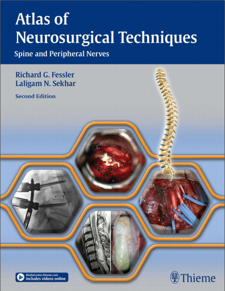 Atlas of Neurosurgical Techniques: Spine and Peripheral Nerves 2nd Edition Original PDF & Video Atlas of Neurosurgical Techniques: Spine and Peripheral Nerves 2nd Edition Original PDF & Video