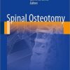 Spinal Osteotomy 2015th Edition Spinal Osteotomy 2015th Edition