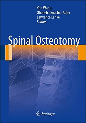 Spinal Osteotomy 2015th Edition Spinal Osteotomy 2015th Edition
