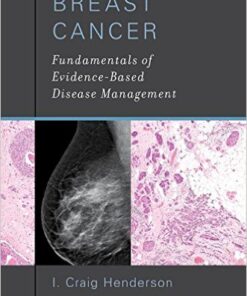 Breast Cancer: Fundamentals of Evidence-Based Disease Management 1st Edition