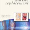 Operative Techniques: Total Knee Replacement 1e Operative Techniques: Total Knee Replacement 1e