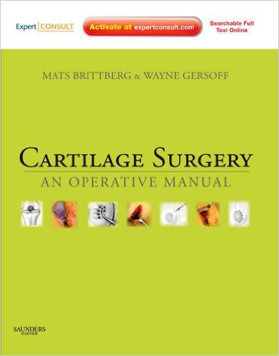 Cartilage Surgery: An Operative Manual 1e Cartilage Surgery: An Operative Manual 1e
