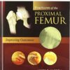 Fractures of the Proximal Femur: Improving Outcomes1e 1st Edition Fractures of the Proximal Femur: Improving Outcomes1e 1st Edition