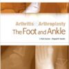 Arthritis and Arthroplasty: The Foot and Ankle: Expert Consult 1e Arthritis and Arthroplasty: The Foot and Ankle: Expert Consult 1e