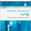 Arthritis and Arthroplasty: The Hip: Expert Consult 1e Arthritis and Arthroplasty: The Hip: Expert Consult 1e