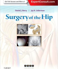Surgery of the Hip: Expert Consult – 1e Har/Psc Edition