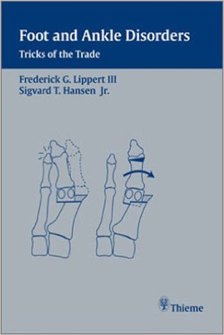 Foot and Ankle Disorders: Tricks of the Trade 1st Edition Foot and Ankle Disorders: Tricks of the Trade 1st Edition