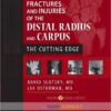 Fractures and Injuries of the Distal Radius and Carpus: The Cutting Edge 1e Fractures and Injuries of the Distal Radius and Carpus: The Cutting Edge 1e