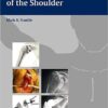 Rotator Cuff Deficiency of the Shoulder 1st Edition Rotator Cuff Deficiency of the Shoulder 1st Edition