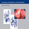 Posterolateral Knee Injuries: Anatomy, Evaluation, and Treatment 1st Edition Posterolateral Knee Injuries: Anatomy, Evaluation, and Treatment 1st Edition