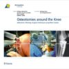 Osteotomies Around the Knee: Indications – Planning – Surgical techniques using Plate Fixators 1st Edition Osteotomies Around the Knee: Indications – Planning – Surgical techniques using Plate Fixators 1st Edition