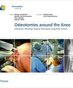 Osteotomies Around the Knee: Indications – Planning – Surgical techniques using Plate Fixators 1st Edition