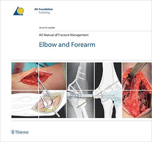 AO Manual of Fracture Management: Elbow & Forearm 1st Edition AO Manual of Fracture Management: Elbow & Forearm 1st Edition