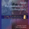 Core Knowledge in Orthopaedics: Adult Reconstruction and Arthroplasty, 1e 1st Edition Core Knowledge in Orthopaedics: Adult Reconstruction and Arthroplasty, 1e 1st Edition