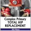 Complex Primary Total Hip Replacement 1st Edition Complex Primary Total Hip Replacement 1st Edition