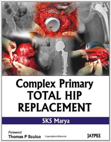 Complex Primary Total Hip Replacement 1st Edition Complex Primary Total Hip Replacement 1st Edition