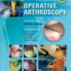 Operative Arthroscopy Fourth Edition Operative Arthroscopy Fourth Edition