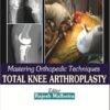 Mastering Orthopedic Techniques Total Knee Arthroplasty 1st Edition Mastering Orthopedic Techniques Total Knee Arthroplasty 1st Edition