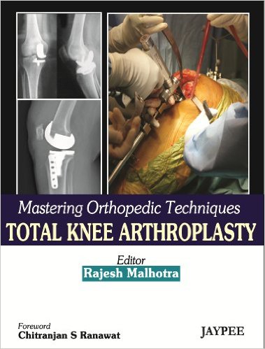 Mastering Orthopedic Techniques Total Knee Arthroplasty 1st Edition Mastering Orthopedic Techniques Total Knee Arthroplasty 1st Edition