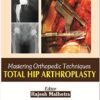 Mastering Orthopedic Techniques Total Hip Arthroplasty Kindle Edition Mastering Orthopedic Techniques Total Hip Arthroplasty Kindle Edition