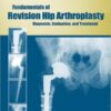 Fundamentals of Revision Hip Arthroplasty: Diagnosis, Evaluation, and Treatment 1st Edition Fundamentals of Revision Hip Arthroplasty: Diagnosis, Evaluation, and Treatment 1st Edition
