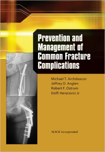 Prevention and Management of Common Fracture Complications 1st Edition Prevention and Management of Common Fracture Complications 1st Edition