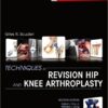 Techniques in Revision Hip and Knee Arthroplasty, 1e 1 Har/Psc Edition Techniques in Revision Hip and Knee Arthroplasty, 1e 1 Har/Psc Edition