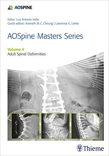 AOSpine Masters Series, Volume 4: Adult Spinal Deformities Kindle Edition AOSpine Masters Series, Volume 4: Adult Spinal Deformities Kindle Edition