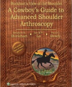 Burkhart’s View of the Shoulder: A Cowboy’s Guide to Advanced Shoulder Arthroscopy