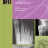 Manual of Orthopaedics, 7e (Lippincott Manual) Seventh Edition Manual of Orthopaedics, 7e (Lippincott Manual) Seventh Edition