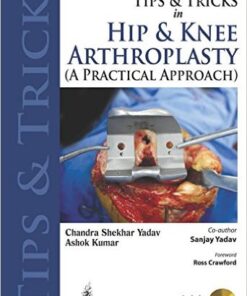 Tips and Tricks in Hip and Knee Arthroplasty: A Practical Approach 1 Edition
