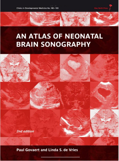 An Atlas of Neonatal Brain Sonography-Original PDF An Atlas of Neonatal Brain Sonography-Original PDF