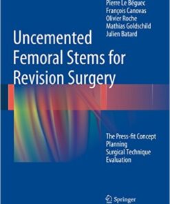 Uncemented Femoral Stems for Revision Surgery: The Press-fit Concept – Planning – Surgical Technique – Evaluation Kindle Edition