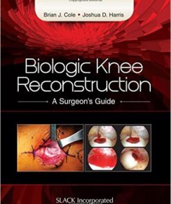 Biologic Knee Reconstruction: A Surgeon’s Guide 1st Edition