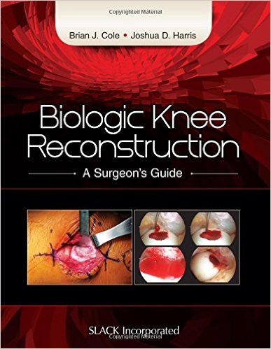 Biologic Knee Reconstruction: A Surgeon’s Guide 1st Edition Biologic Knee Reconstruction: A Surgeon’s Guide 1st Edition