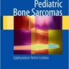 Pediatric Bone Sarcomas: Epiphysiolysis before excision 2009th Edition Pediatric Bone Sarcomas: Epiphysiolysis before excision 2009th Edition