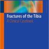 Fractures of the Tibia: A Clinical Casebook 1st ed. 2016 Edition Fractures of the Tibia: A Clinical Casebook 1st ed. 2016 Edition