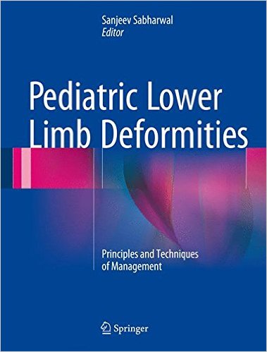 Pediatric Lower Limb Deformities: Principles and Techniques of Management 1st ed. 2016 Edition Pediatric Lower Limb Deformities: Principles and Techniques of Management 1st ed. 2016 Edition