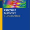 Dupuytren’s Contracture: A Clinical Casebook 1st ed. 2016 Edition