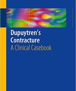 Dupuytren’s Contracture: A Clinical Casebook 1st ed. 2016 Edition