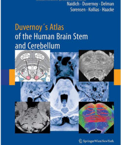 Duvernoy’s Atlas of the Human Brain Stem and Cerebellum: High-Field MRI, Surface Anatomy, Internal Structure, Vascularization and 3 D Sectional Anatomy 1st Edition