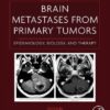 Brain Metastases from Primary Tumors. Epidemiology, Biology, and Therapy Volume 1 Brain Metastases from Primary Tumors. Epidemiology, Biology, and Therapy Volume 1